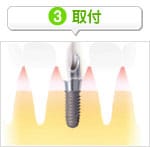 治療の流れ